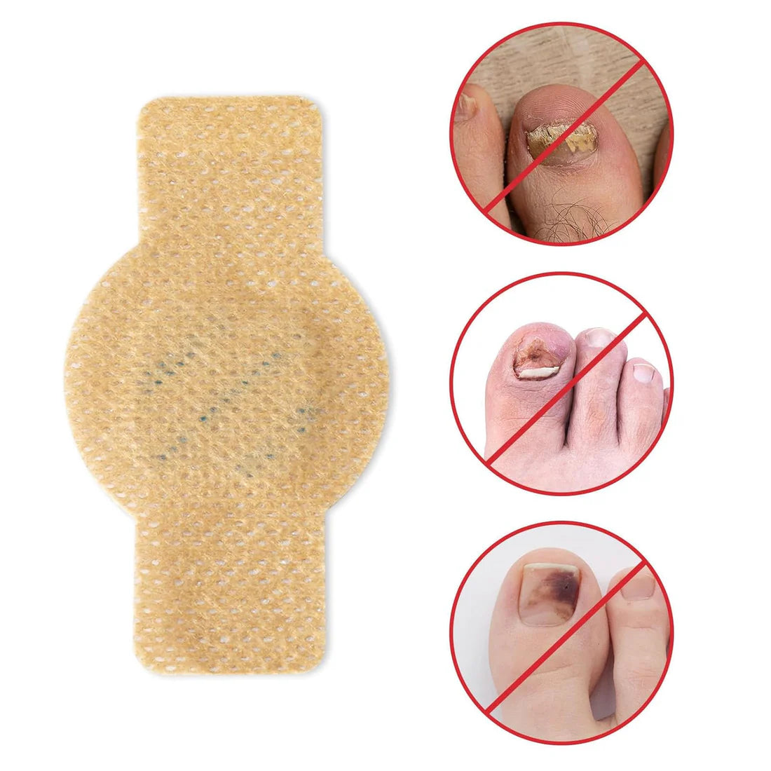 NailHeal™ - Parches para hongos en las uñas